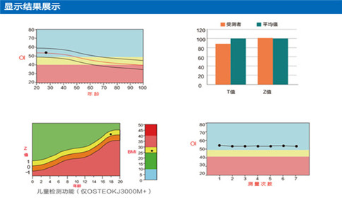 國(guó)產(chǎn)骨密度儀品牌